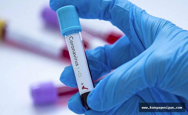 Sağlık Bakanlığı'ndan koronavirüs testi açıklaması: Tek tıkla ulaşabilirsiniz!