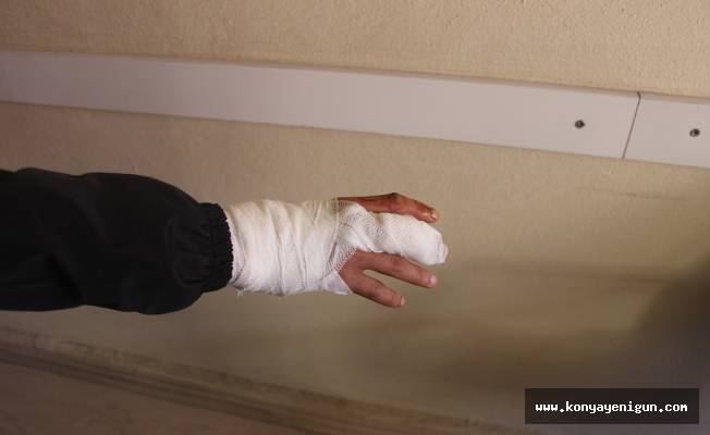 Karapınar’da sokak köpeğinin  saldırdığı genç yaralandı