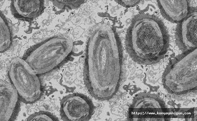 Güney Kore'de ilk maymun çiçeği virüsü vakası tespit edildi
