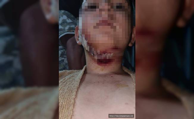 Konya'da köpeğin saldırdığı çocuk hastanelik oldu